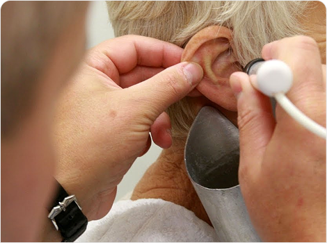 Tips to Prevent Ear Wax Buildup